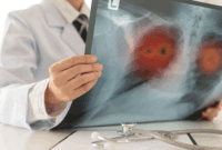 Ilustrasi CT Scan. Banyak mitos tentang kanker paru membuat orang merasa tidak berisiko, padahal penyakit ini bisa terjadi pada siapa saja dan sering terlambat terdeteksi.(SHUTTERSTOCK/create jobs 51)