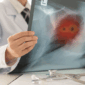 Ilustrasi CT Scan. Banyak mitos tentang kanker paru membuat orang merasa tidak berisiko, padahal penyakit ini bisa terjadi pada siapa saja dan sering terlambat terdeteksi.(SHUTTERSTOCK/create jobs 51)